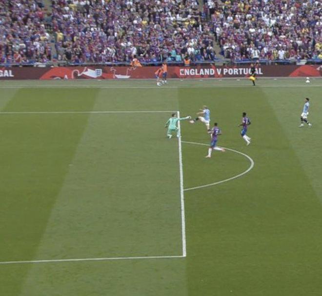 尤文官方：加蒂右膝内侧半月板受伤，将接受手术（尤文官宣：加蒂右膝内侧半月板受伤，将接受手术治疗）